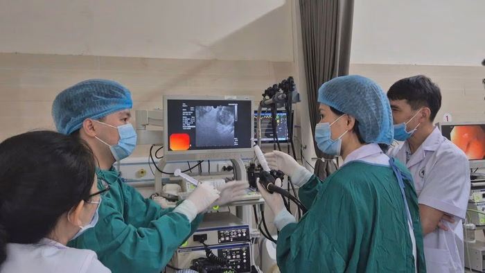 Kỹ thuật EUS-FNB giúp lấy mẫu mô chính xác từ khối u tụy mà không cần phẫu thuật xâm lấn lớn. Ảnh: BVCC.