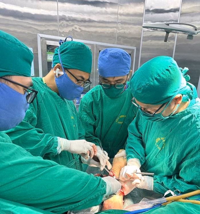 Đội ngũ bác sĩ khoa Chỉnh hình - Bỏng tập trung cao độ để nối lại các mạch máu và thần kinh siêu nhỏ cho bệnh nhân.